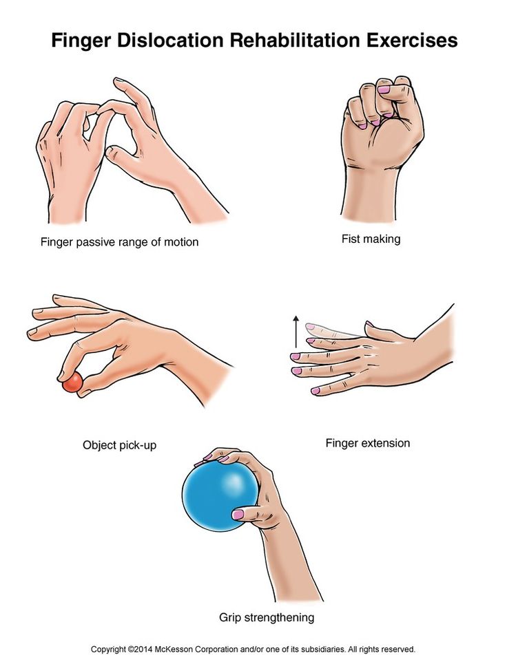 Finger Rehabilitation Exercises