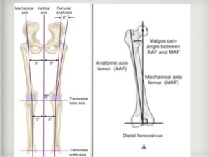 Mechanical axis of the knee joint