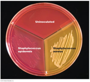Growing culture of Staphylococcus aureus bacteria